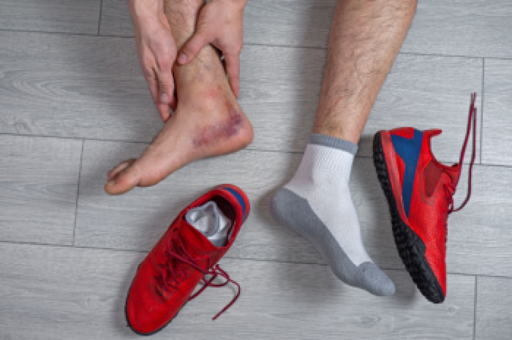 Chronic Ankle Instability and Recurring Lateral Sprains