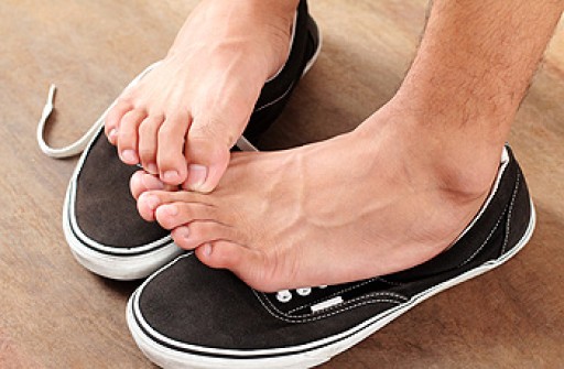 What Causes Flat Feet