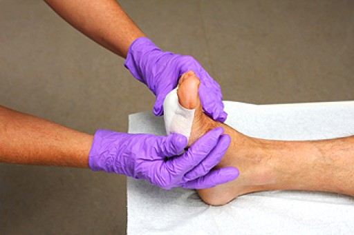 Non Diabetic Foot Wounds