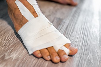 Causes of a Sprained Toe