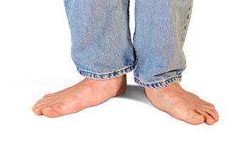 How Flat Feet Are Diagnosed