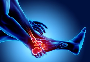 Differentiating Between Foot Stress Fractures and Stress Reaction