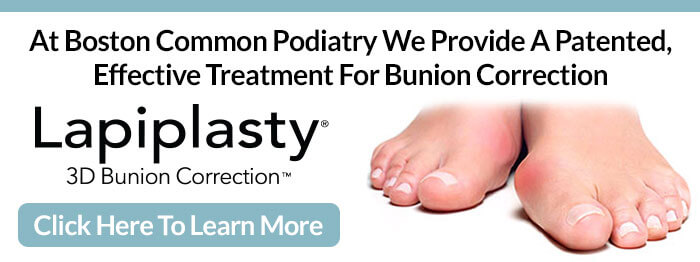 Lapiplasty® 3D Bunion Correction