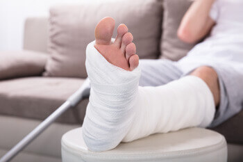 ankle fracture