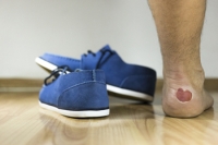 The Prevention and Care of Blisters